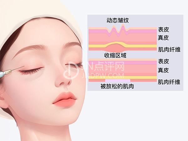 眼部衰老的原因及抗衰治疗分析