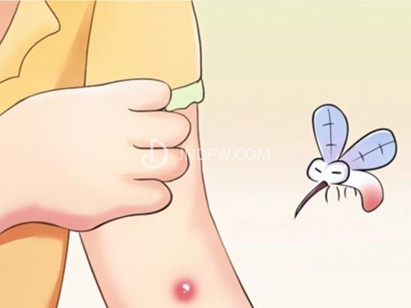 血糖高容易招来蚊虫叮咬吗？